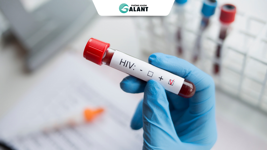Phương pháp xét nghiệm HIV bằng huyết học