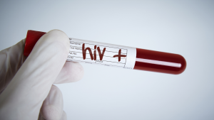 Xét nghiệm hiv