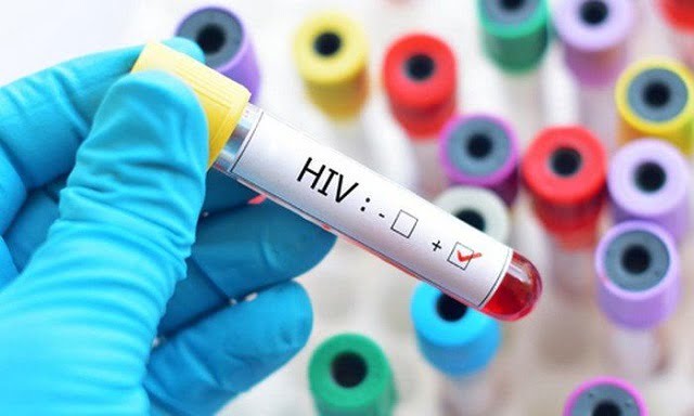 Avonza làm giảm số lượng virus HIV tồn tại trong cơ thể người bệnh