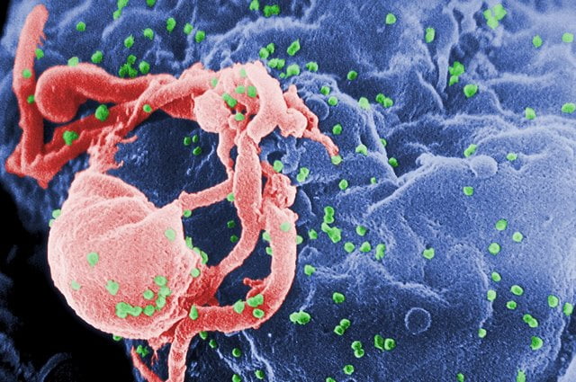 Các virus HIV sẽ tấn công và phá hủy các tế bào Lympho CD4+ ở người, làm suy giảm hệ miễn dịch