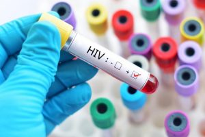 Ghi nhớ các cột mốc quan trọng để xét nghiệm HIV Ag/Ab