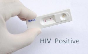 Kết quả xét nghiệm nhanh dương tính khi sử dụng bộ test HIV