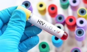 Xét nghiệm HIV PCR chính là một bước đột phá trong ngành y khoa