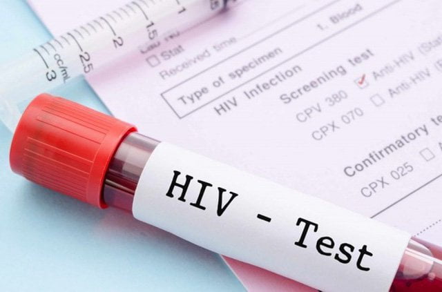 Xét nghiệm HIV thường cho ra kết quả âm tính trong giai đoạn cửa sổ
