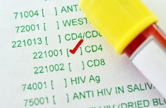 Xét nghiệm cd4 thường xuyên giúp người nhiễm HIV/AIDS điều trị bệnh hiệu quả, kéo dài tuổi thọ