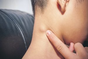 HIV giai đoạn đầu có triệu chứng gì: Xuất hiện hạch to ở giai đoạn đầu nhiễm HIV