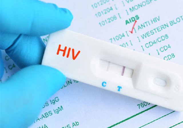 Dễ dàng thực hiện xét nghiệm HIV ngay tại nhà