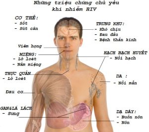 hiv-giai-doan-dau-co-chua-duoc-khong-1