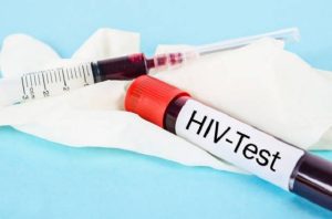 Xét nghiệm HIV ab là gì?