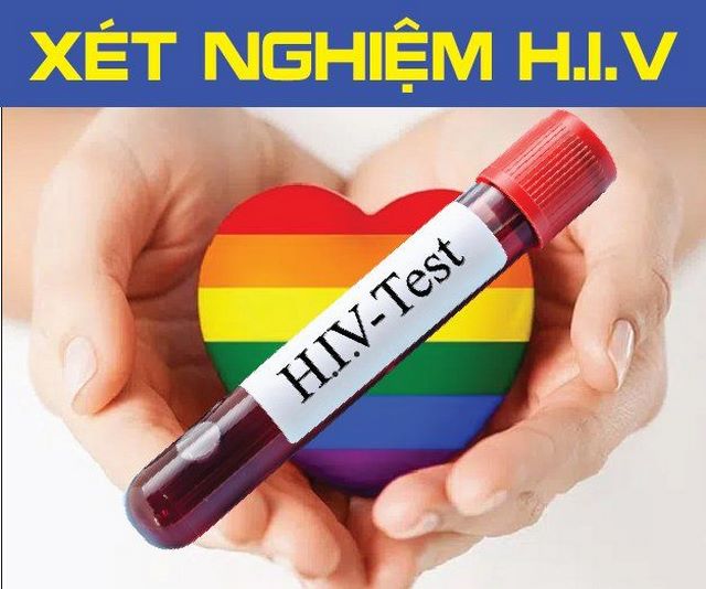 Ảnh 1: Nhóm đối tượng nguy cơ cao nên làm xét nghiệm HIV mỗi năm một lần