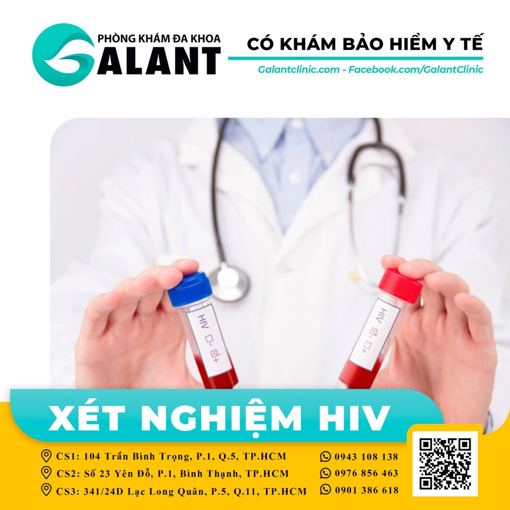 Ảnh 1: Xét nghiệm khẳng định HIV là một dạng xét nghiệm bổ sung
