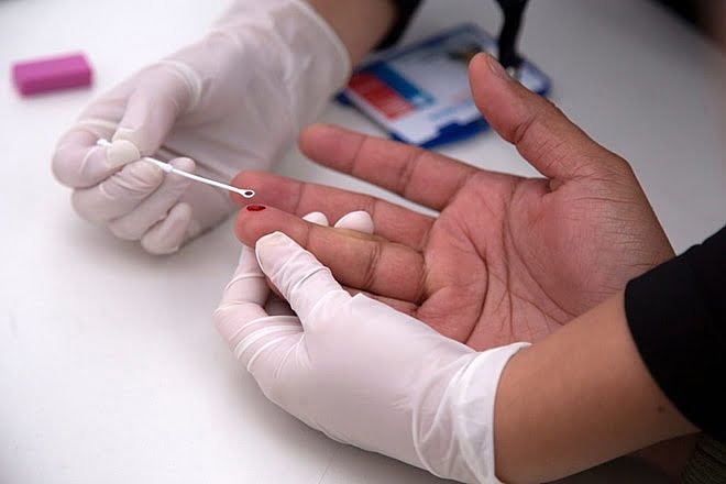 Ảnh 2: Test nhanh HIV áp dụng với nhóm đối tượng có nguy cơ lây nhiễm cao