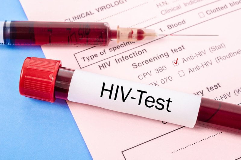Ảnh 4: Giai đoạn cấp tính xét nghiệm sàng lọc vẫn rất khó phát hiện virus HIV