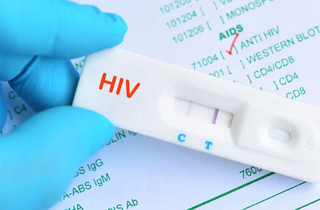 Các phương pháp xét nghiệm HIV phổ biến