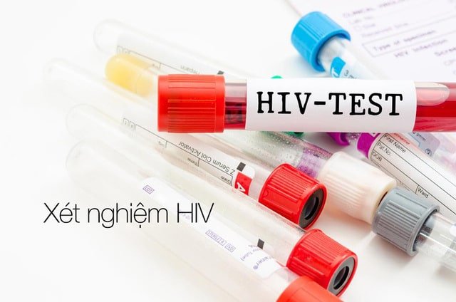 Để có kết quả chính xác nhất, các đối tượng bị phơi nhiễm nên xét nghiệm HIV sau 6 tháng