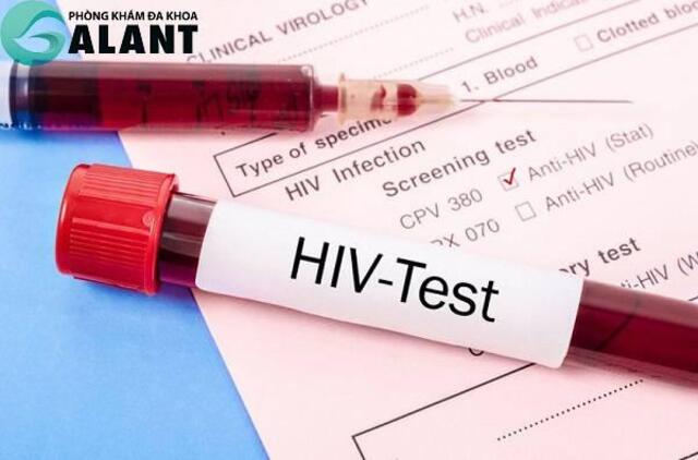 Đối tượng có nguy cơ lây nhiễm cao luôn phải ghi nhớ các cột mốc quan trọng này để tiến hành xét nghiệm HIV
