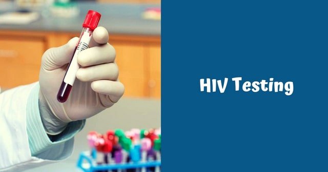 Xét nghiệm HIV có thẻ BHYT sẽ được bên bảo hiểm thanh toán