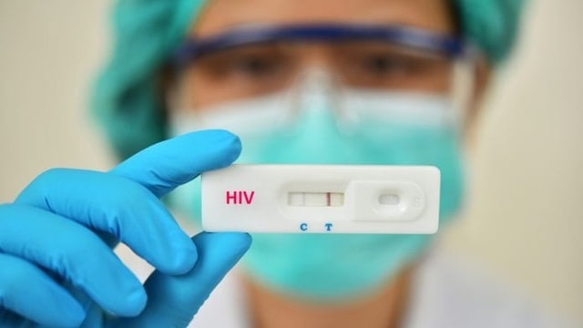 Xét nghiệm HIV phát hiện kháng thể kháng virus HIV cần thời gian từ 1 đến 6 tháng