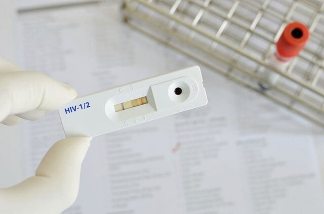 Xét nghiệm HIV sau 2 tháng kết quả âm tính hay dương tính vẫn chưa thể khẳng định người đó có bị nhiễm HIV hay không