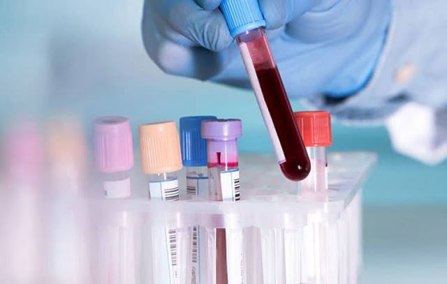 Xét nghiệm máu có ý nghĩa quan trọng trong việc chẩn đoán và kiểm soát nguy cơ mắc bệnh