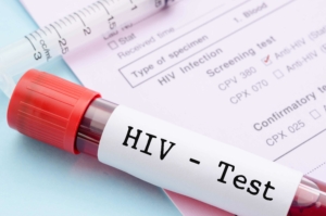 xét nghiệm hiv ab test nhanh