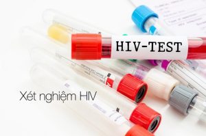 Xét nghiệm HIV sau 6 tháng có chính xác không?