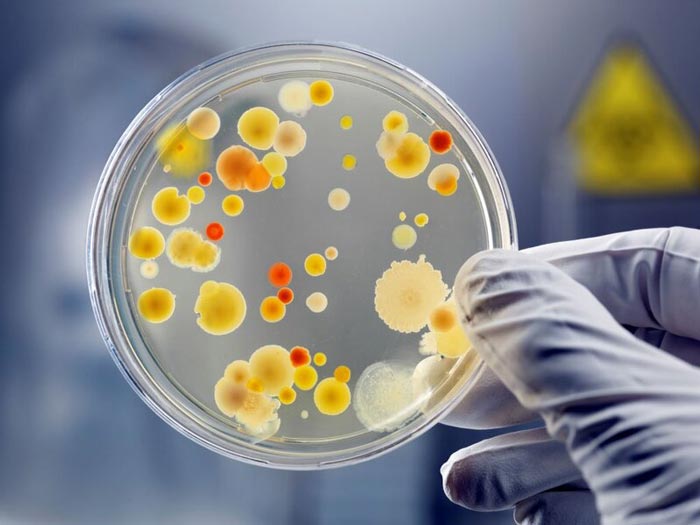 Hình 3: Phương pháp xét nghiệm nuôi cấy vi khuẩn