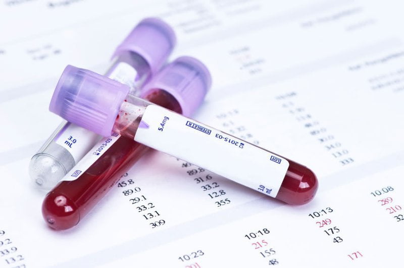 Bạn sẽ được xét nghiệm máu để tìm kháng thể kháng giang mai giai đoạn 3