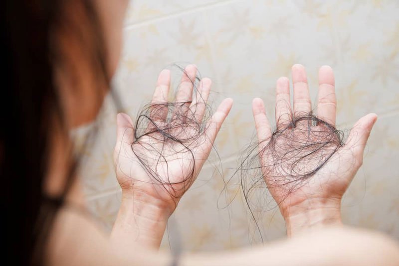 Bệnh giang mai ở nữ giới gây rụng tóc hàng loạt