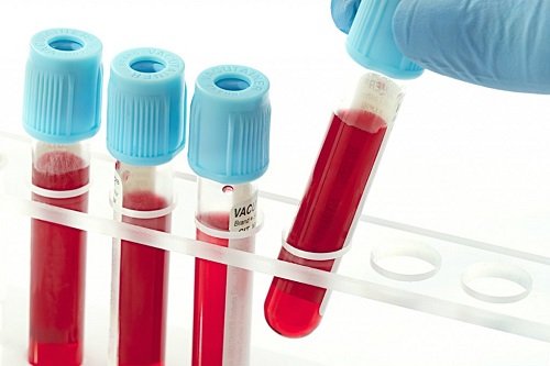 Mẫu máu sau khi được lấy ra sẽ được đưa vào phòng thí nghiệm để bảo quản và phân tích