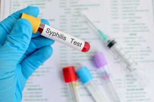 Bạn nên xét nghiệm Syphilis Test nhanh khi nghi ngờ mình đang mắc bệnh giang mai