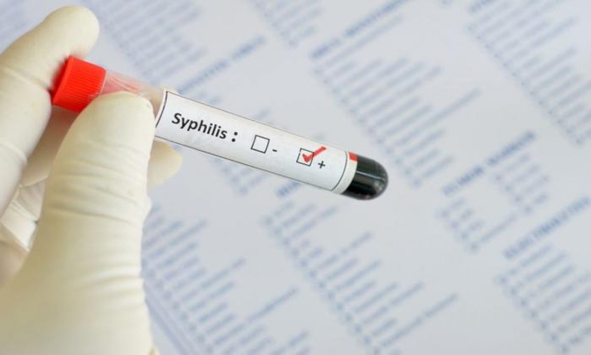 Syphilis test nhanh cho kết quả xét nghiệm giang mai chuẩn xác chỉ từ 70 - 90%