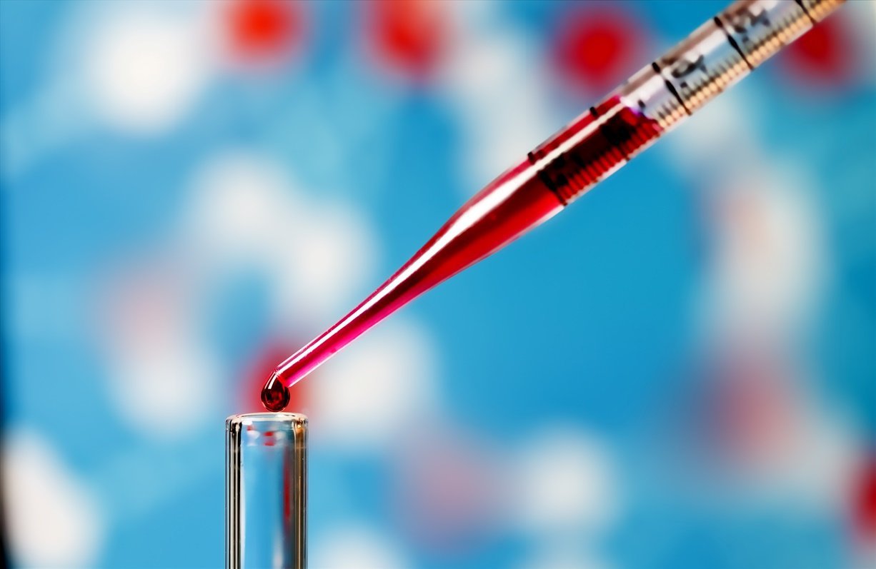 Xét nghiệm máu giúp tìm ra nguyên nhân bệnh lậu chuẩn xác nhất