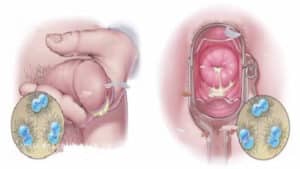 Biểu hiện bệnh lậu ở nam giới và nữ giới