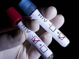 Liệu xét nghiệm HIV bằng que test có chính xác không?