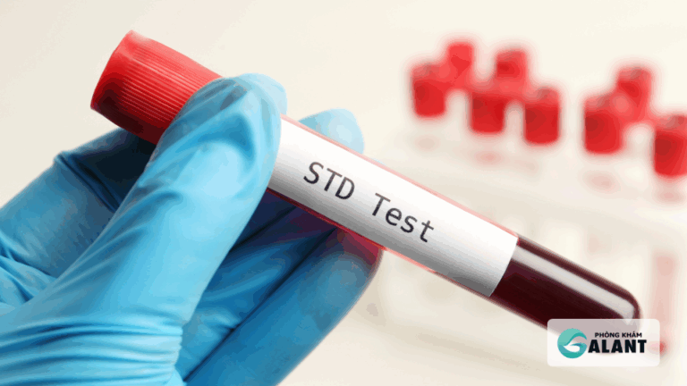xét nghiệm tầm soát bệnh tình dục