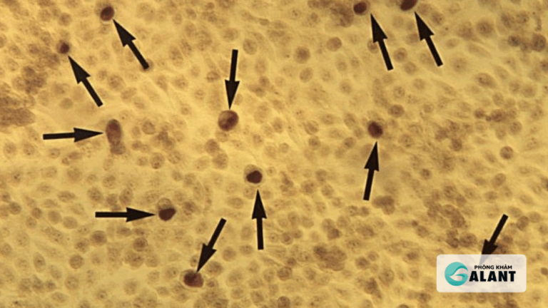 Bị Chlamydia được quan hệ không?