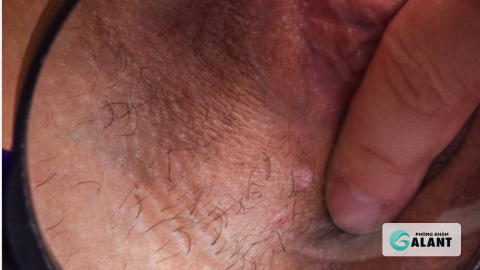 Cách phòng ngừa giang mai hiệu quả, 7 bí quyết bảo vệ sức khỏe tình dục