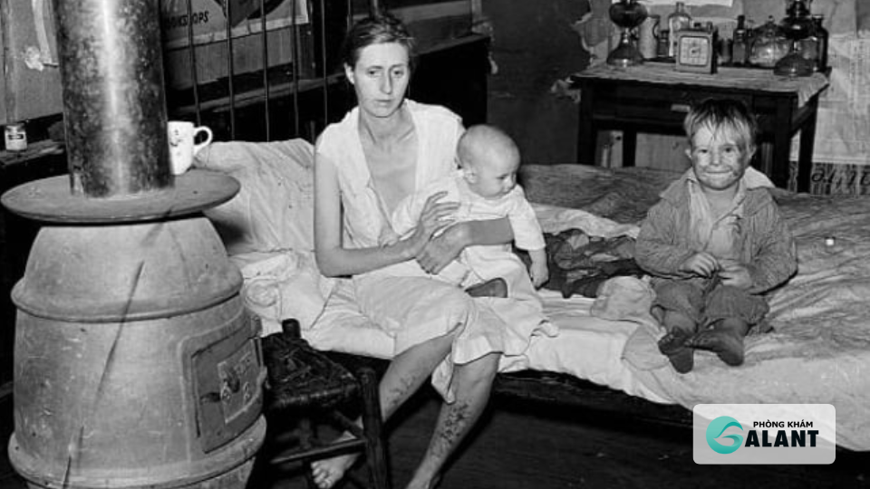 Bệnh Giang mai có nguy hiểm, từng gieo khiếp sợ trong quá khứ