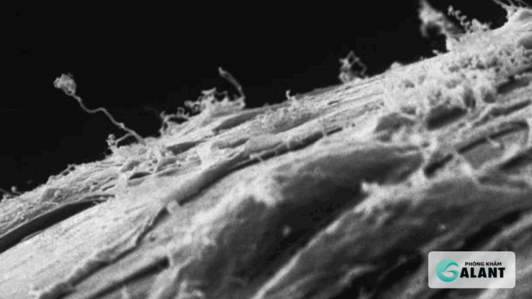 Giang Mai ảnh hưởng đến nhiều cơ quan