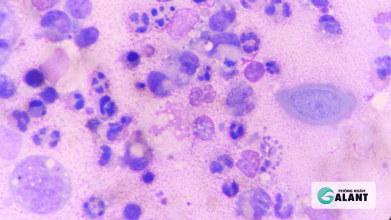 xét nghiệm herpes ở đâu