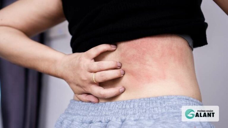 Triệu chứng ban đầu HIV