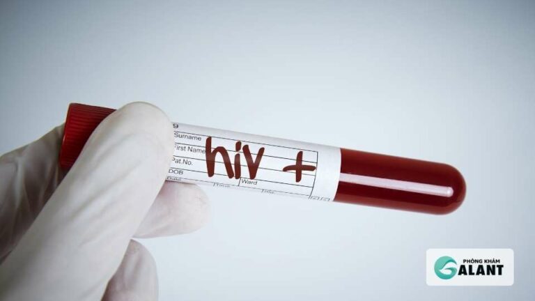 Xét nghiệm HIV Hà Nội Kiểm tra định kỳ