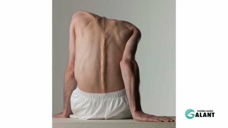 Triệu chứng HIV giai đoạn cuối, Hệ miễn dịch bị tàn phá nghiêm trọng