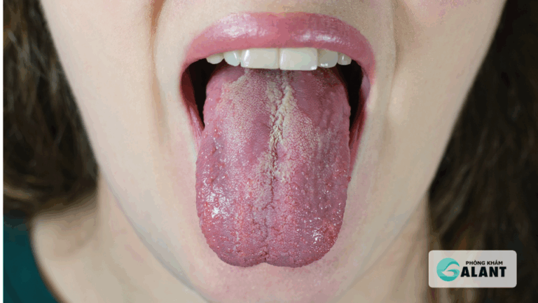 Sùi mào gà có lây qua quan hệ miệng