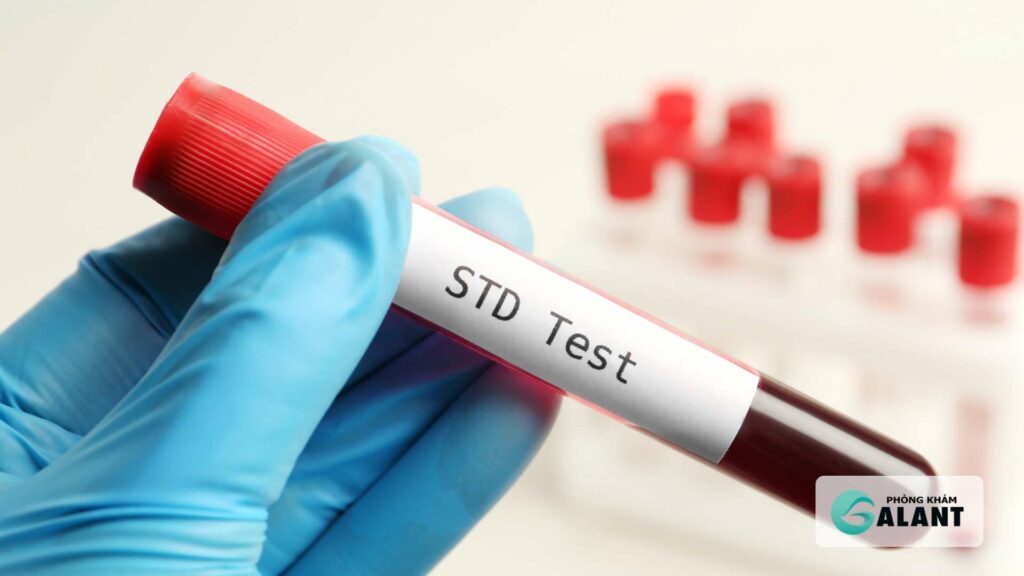 Lậu và giang mai và HIV test