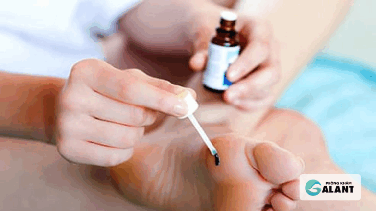 Podophyllotoxin trị sùi mào gà