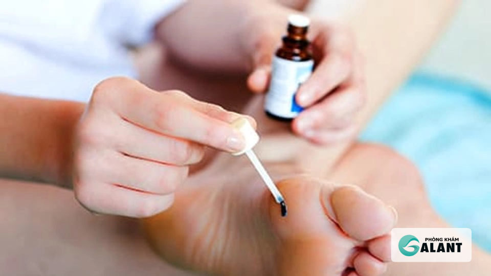 Thuốc điều trị sùi mào gà: Các loại phổ biến, cách dùng và lưu ý