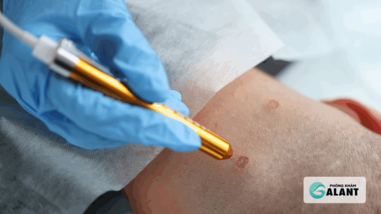 Phương pháp điều trị Sùi mào gà