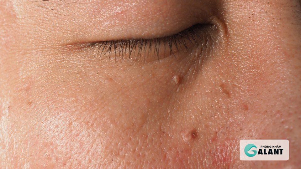 Tiêm HPV cho nam giới: Có nên tiêm, bao nhiêu mũi, giá bao nhiêu?